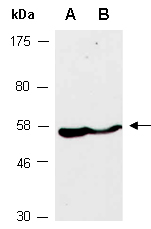 P4HB Antibody Western (Abiocode)
