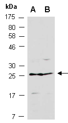 ZNRF2 Antibody Western (Abiocode)