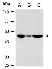 PSEN2 Antibody Western (Abiocode)