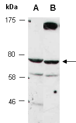 MPP5 Antibody Western (Abiocode)