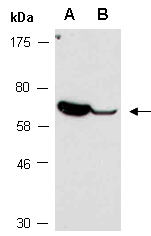 MED17 Antibody Western (Abiocode)
