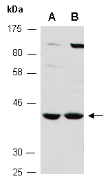 NKX6-1 Antibody Western (Abiocode)