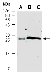 COMMD9 Antibody Western (Abiocode)