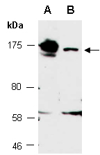 ASAP1 Antibody Western (Abiocode)