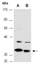 FOXR2 Antibody Western (Abiocode)