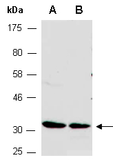 LDLRAP1 Antibody Western (Abiocode)