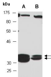 MBD3 Antibody Western (Abiocode)