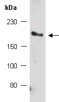 GLI2 Antibody Western (Abiocode)