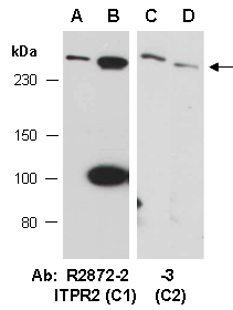 ITPR2 Antibody Western (Abiocode)