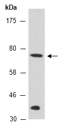 ETR1 Antibody Western (Abiocode)