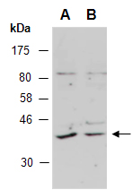 GSX2 Antibody Western, Abiocode