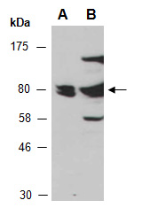 PRKCB Antibody Western, Abiocode