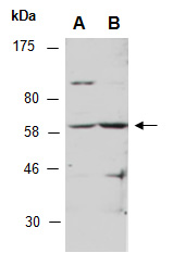 GLIS2 Antibody Western, Abiocode