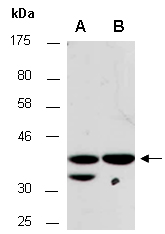 RNF41 Antibody Western, Abiocode