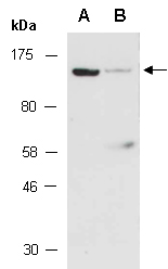 TRPS1 Antibody Western (Abiocode)