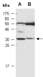 RAB27A Antibody Western (Abiocode)