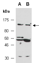 BCR Antibody Western (Abiocode)