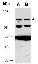 MN1 Antibody Western (Abiocode)