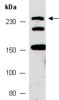 NOTCH1 Antibody Western (Abiocode)