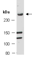 SETD1B Antibody Western (Abiocode)