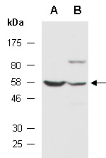 SNX31 Antibody Western (Abiocode)
