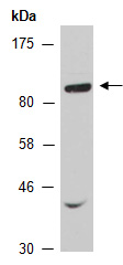 CLV1 Antibody (Abiocode) Western
