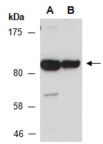 L3MBTL Antibody Western (Abiocode)