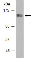 NFATC2 Antibody Western (Abiocode)