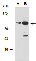 SRGAP3 Antibody Western (Abiocode)