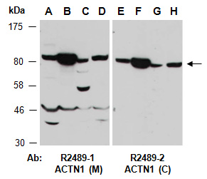 ACTN1 Antibody Western (Abiocode)