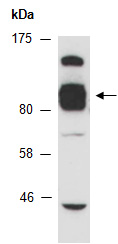 DLG4 Antibody Western (Abiocode)