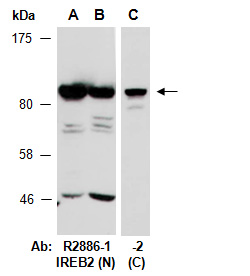 IREB2 Antibody Western (Abiocode)