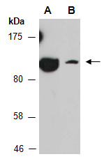 ACTN2 Antibody Western (Abiocode)