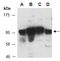 FOXK1 Antibody Western (Abiocode)