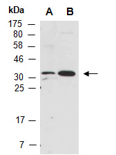 IL21A Antibody Western (Abiocode)