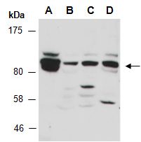 DLG1 Antibody Western (Abiocode)