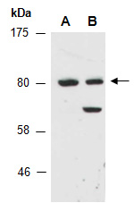 PIK3R1 Antibody Western (Abiocode)