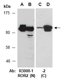 ROR2 Antibody Western (Abiocode)