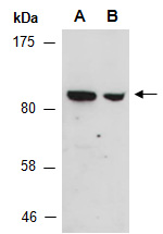 PIWIL3 Antibody Western (Abiocode)