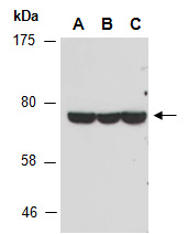 FOXK2 Antibody Western (Abiocode)