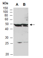 SETD7 Antibody Western (Abiocode)