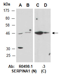 SERPINA1 Antibody Western (Abiocode)