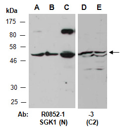 SGK1 Antibody Western (Abiocode)