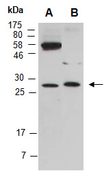 MED6 Antibody Western (Abiocode)