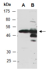 SS18 Antibody Western (Abiocode)