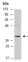 HOXC11 Antibody Western (Abiocode)