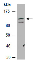 EML4 Antibody Western (Abiocode)