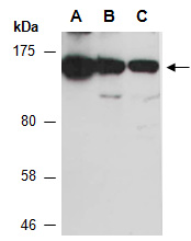 SF3B1 Antibody Western (Abiocode)