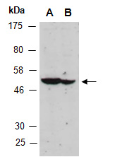 VPS4A Antibody Western (Abiocode)