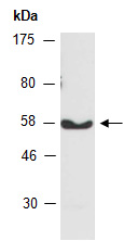 PPP3CA Antibody Western (Abiocode)